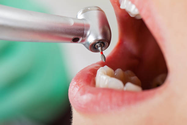 Best Emergency Treatment for Dental Infections or Abscesses in Lucerne Valley, CA